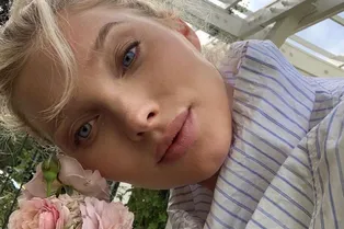 6 вопросов о фотоомоложении BBL — любимой процедуре голливудских звезд