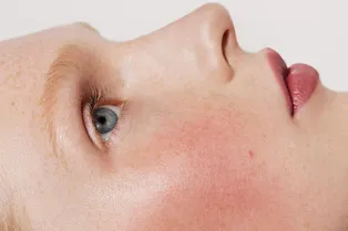 Кислоты для лица: какие выбрать