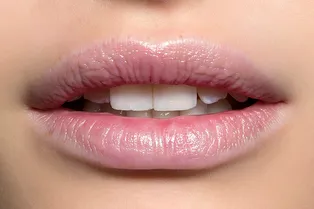 Зуб дает: вся правда об отбеливании и винирах от главного врача клиники Aesthetica