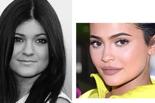 Бьюти-эволюция Кайли Дженнер, или История трансформации губ самой юной миллиардерши