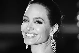 Гармонизирующая хирургия: почему нам всем стоит забыть о внешности Анджелины Джоли