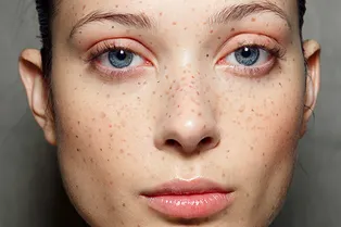 Как создать фейковые веснушки Как создать фейковые веснушки