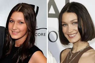 Как Блейк Лайвли, Белла Хадид и другие звезды выглядели до пластических операций