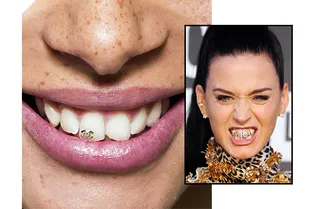 Украшения для зубов, как у рэперов нулевых — новый тренд