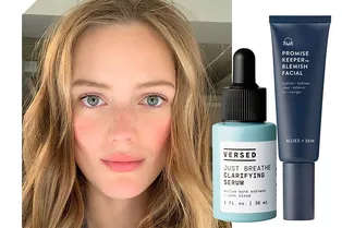 От прыщей, покраснений и морщин: в какой косметике искать ниацинамид