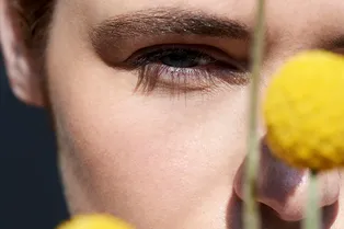 Покраснения, шелушения и зуд после солнца: что такое фотодерматит