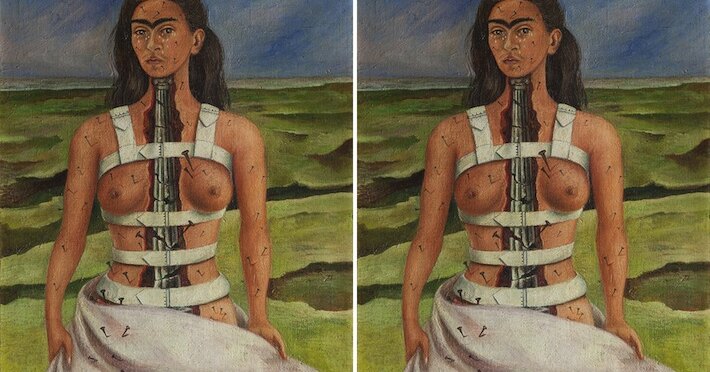 Por qué se murió frida kahlo