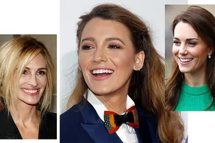 Как Энн Хэтэуэй, Джулия Робертс, Кейт Миддлтон и другие звезды добились идеальной улыбки